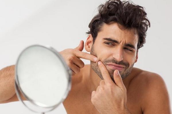 Εσωτερικά αίτια της ακμής δέρματος
